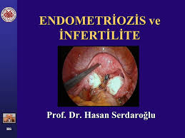 gebe-kalmadan-once-endometriozis